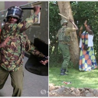 After The Brutal Force By Police At The Demonstration Earlier Today, CORD Leaders Visit Victims In Hospital