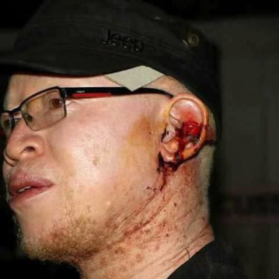 after Julius Yego, Victor Wanyama gets his own theme song courtesy of Machakos Kyalo