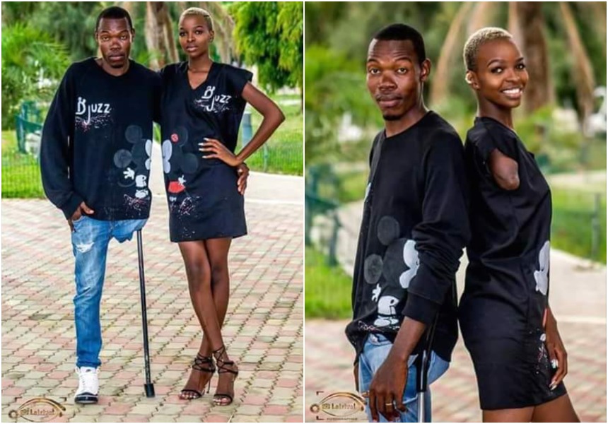 Love Is Blind! Amputee Couple Shares Cute Photos