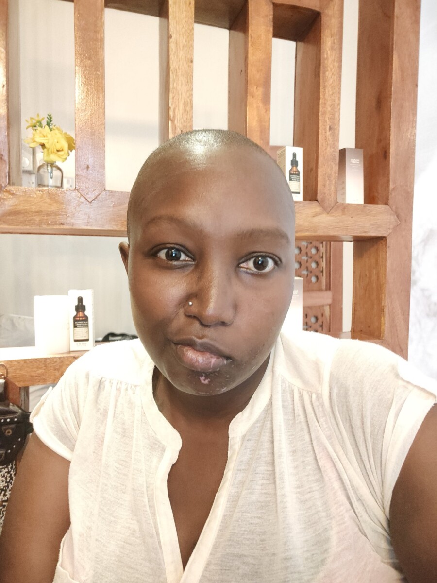 Annitah Raey has been silently battling Bell's Paralysis. Photo credit: Twitter/AnnitahRaey