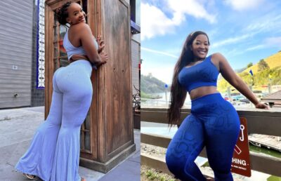 Musician Miracle Baby to undergo 2nd surgery to fix his intestines 