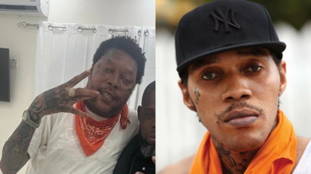 Why is Vybz Kartel's face swollen? Everything to know about disease ...