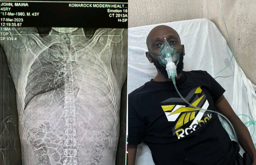 An X-ray image showing MC Fullstop's lungs [L]. MC Fullstop breathing through an oxygen mask [right]. PHOTOS/Instagram/@mc_fullstop