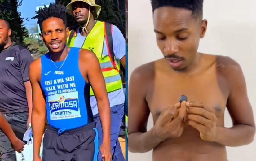 Eric Omondi skin